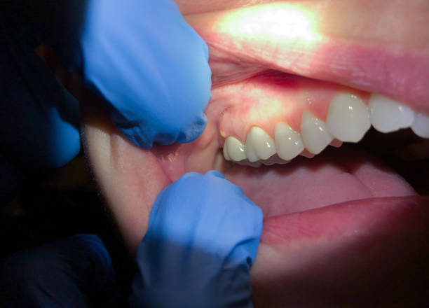 Best Emergency Broken Tooth Repair in Park City, TN