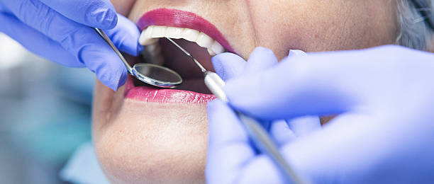 Best Emergency Treatment for Toothache in Park City, TN